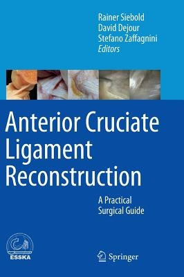 Anterior Cruciate Ligament Reconstruction: A Practical Surgical Guide by Siebold, Rainer
