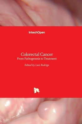 Colorectal Cancer: From Pathogenesis to Treatment by Rodrigo, Luis
