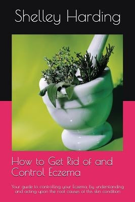 How to get Rid of and Control Eczema: Your guide to controlling your Eczema, by understanding and acting upon the root causes of this skin condition by Harding, Shelley