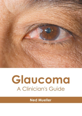 Glaucoma: A Clinician's Guide by Mueller, Ned