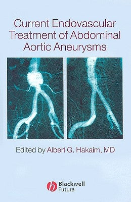 Current Endovascular Treatment of Abdominal Aortic Aneurysms by Hakaim, Albert G.