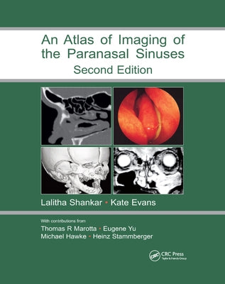 An Atlas of Imaging of the Paranasal Sinuses by Shankar, Lalitha