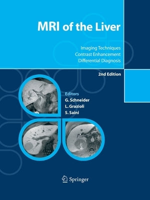 MRI of the Liver: Imaging Techniques, Contrast Enhancement, Differential Diagnosis by Schneider, Günther