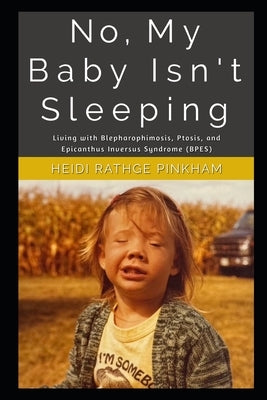 No, My Baby Isn't Sleeping: A Life with with Blepharophimosis, Ptosis, and Epicanthus Inversus Syndrome (BPES) by Rathge-Pinkham, Heidi