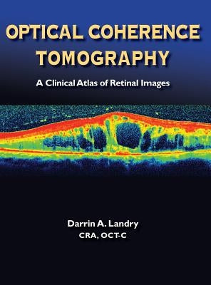 Optical Coherence Tomography by Darrin, A. Landry