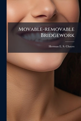 Movable-removable Bridgework by Herman E S Chayes