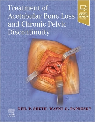 Treatment of Acetabular Bone Loss and Chronic Pelvic Discontinuity by Sheth, Neil P.
