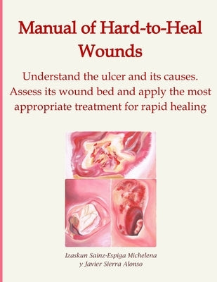 Manual of Hard-to-Heal Wounds: Understand the ulcer and its causes. Assess its wound bed and implement the most appropriate treatment for rapid healin by Sierra Alonso, Javier