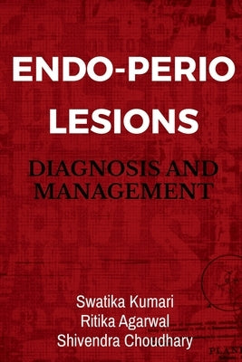 Endo-Perio Lesions by Kumari, Swatika