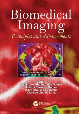 Biomedical Imaging: Principles and Advancements by Pinheiro Dos Santos, Wellington
