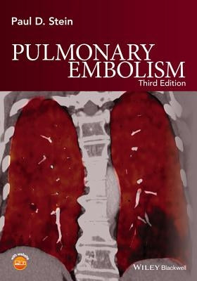 Pulmonary Embolism by Stein, Paul D.