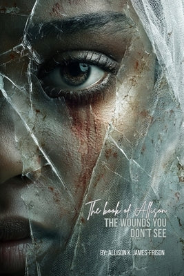 The Book of Allison: The Wounds You Don't See by James -. Frison, Allison K.