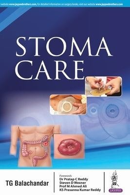 Stoma Care by Tg, Balachandar