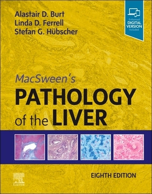 Macsween's Pathology of the Liver by Burt, Alastair D.