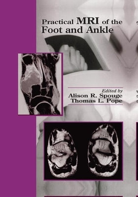 Practical MRI of the Foot and Ankle by Spouge, Alison R.