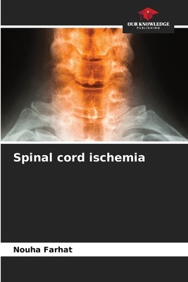 Spinal cord ischemia by Farhat, Nouha