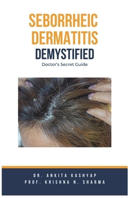 Seborrheic Dermatitis Demystified: Doctor's Secret Guide by Kashyap, Ankita
