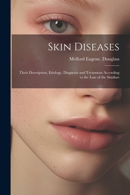 Skin Diseases: Their Description, Etiology, Diagnosis and Treatment According to the Law of the Similars by Douglass, Melford Eugene