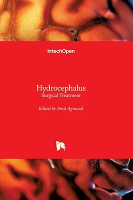 Hydrocephalus - Surgical Treatment: Surgical Treatment by Agrawal, Amit