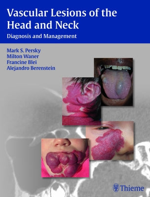 Vascular Lesions of the Head and Neck: Diagnosis and Management by Persky, Mark S.