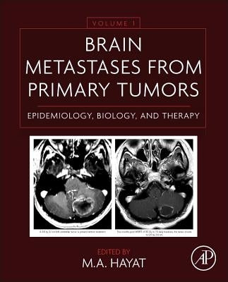 Brain Metastases from Primary Tumors Volume 1: Epidemiology, Biology, and Therapy by Hayat, M. A.