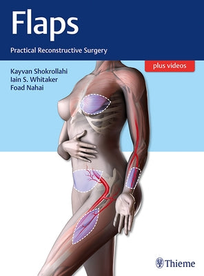 Flaps: Practical Reconstructive Surgery by Shokrollahi, Kayvan