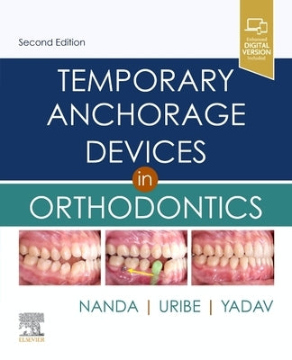 Temporary Anchorage Devices in Orthodontics by Nanda, Ravindra