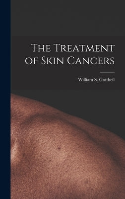 The Treatment of Skin Cancers by Gottheil, William S.