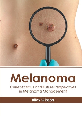 Melanoma: Current Status and Future Perspectives in Melanoma Management by Gibson, Riley