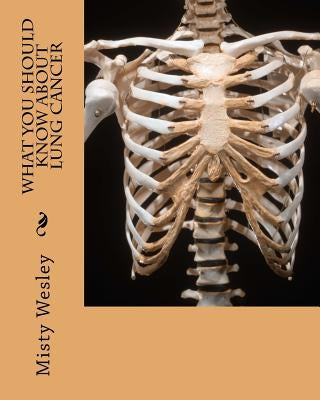 What you should know about Lung Cancer by Wesley, Misty L.