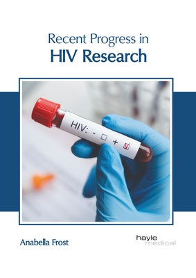 Recent Progress in HIV Research by Frost, Anabella