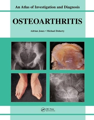 Oesteoarthritis: An Atlas of Investigation and Diagnosis by Jones, Adrian