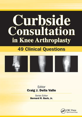 Curbside Consultation in Knee Arthroplasty: 49 Clinical Questions by Della Valle, Craig