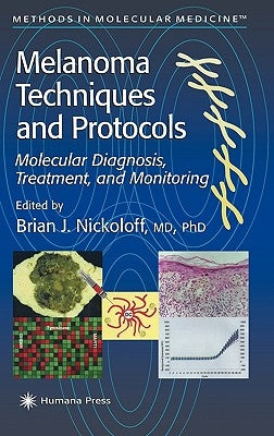 Melanoma Techniques and Protocols: Molecular Diagnosis, Treatment, and Monitoring by Nickoloff, Brian J.