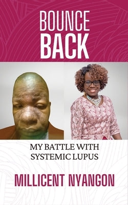 Bounce Back: My Battle With Systemic Lupus by Nyangon, Millicent