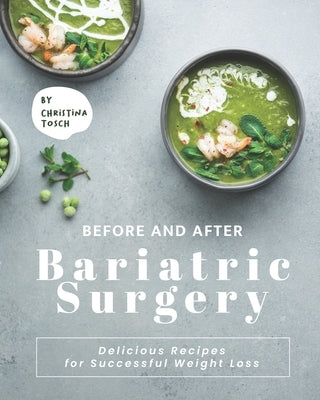 Before and After Bariatric Surgery: Delicious Recipes for Successful Weight Loss by Tosch, Christina
