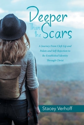 Deeper Than the Scars: A Journey from Cleft Lip and Palate and Self-Rejection to Re-Established Identity Through Christ by Verhoff, Stacey