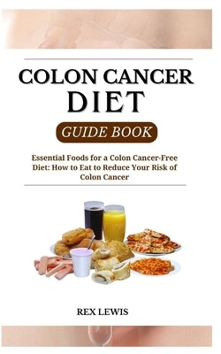 Colon Cancer Diet Guide Book: Essential Foods for a Colon Cancer-Free Diet: How to Eat to Reduce Your Risk of Colon Cancer by Lewis, Rex