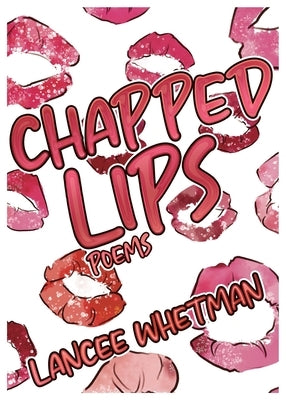 Chapped Lips by Whetman, Lancee