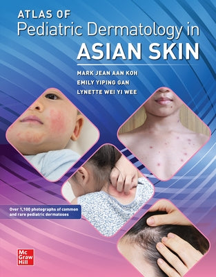 Atlas of Pediatric Dermatology in Asian Skin by Koh, Mark Jean Aan