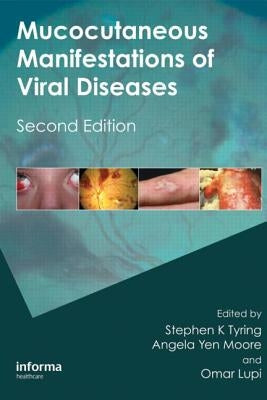 Mucocutaneous Manifestations of Viral Diseases: An Illustrated Guide to Diagnosis and Management by Tyring, Stephen