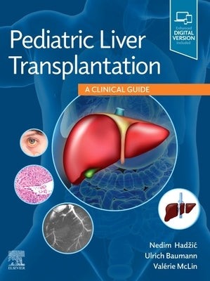 Pediatric Liver Transplantation: A Clinical Guide by Hadzic, Nedim