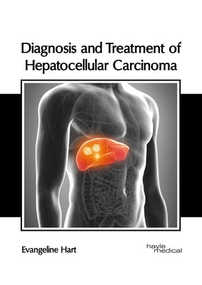 Diagnosis and Treatment of Hepatocellular Carcinoma by Hart, Evangeline