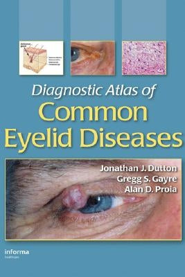 Diagnostic Atlas of Common Eyelid Diseases by Dutton, Jonathan J.