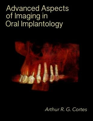 Advanced Aspects of Imaging in Oral Implantology by Cortes, Arthur Rodriguez Gonzalez