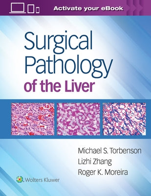 Surgical Pathology of the Liver by Torbenson, Michael