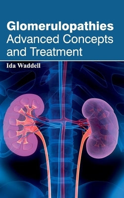 Glomerulopathies: Advanced Concepts and Treatment by Waddell, Ida