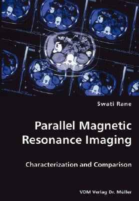 Parallel Magnetic Resonance Imaging by Rane, Swati