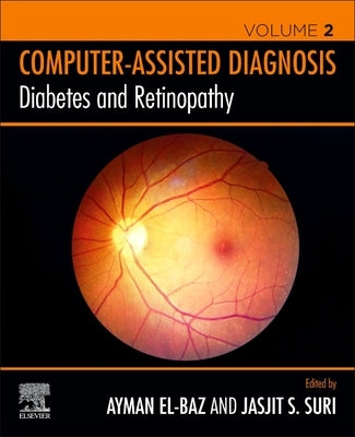 Diabetes and Retinopathy by S. El-Baz, Ayman