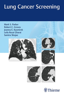 Lung Cancer Screening by Parker, Mark
